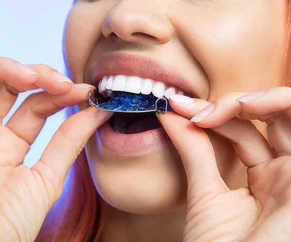 Retainers in Southend, Essex at Stibbards